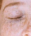 Targeted Dark Spot Care, 1% Kojic Acid